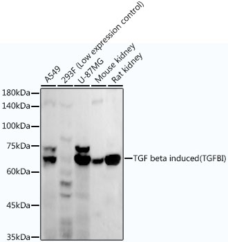 Western blot analysis of various lysates using TGF beta induced (TGFBI) Rabbit mAb at1:10000 dilution.|Secondary antibody: HRP-conjugated Goat anti-Rabbit IgG (H+L) at1:10000 dilution.|Lysates/proteins: 25μg per lane.|Blocking buffer: 3% nonfat dry milk in TBST.|Detection: ECL Enhanced Kit.|Exposure time: 180s.