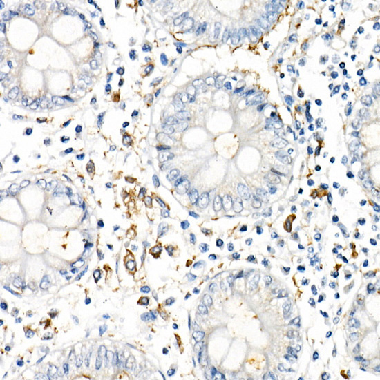 Immunohistochemistry analysis of paraffin-embedded Human colon using TNF-α Rabbit mAb at dilution of 1:1000 (40x lens). High pressure antigen retrieval performed with 0.01M Citrate buffer (pH 6.0) prior to IHC staining.