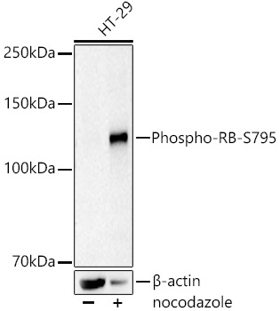 Western blot analysis of various lysates, using Phospho-RB-S795 Rabbit mAb at  1:1000 dilution. HT-29 cells were treated with Nocodazole (100 ng/ml) at 37℃ for 24 hours.|Secondary antibody: HRP-conjugated Goat anti-Rabbit IgG (H+L) at 1:10000 dilution.|Lysates/proteins: 25μg per lane.|Blocking buffer: 3% nonfat dry milk in TBST.|Detection: ECL Basic Kit.|Exposure time: 60s.