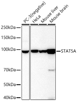 Western blot analysis of various lysates, using STAT5A Rabbit mAb at 1:20000 dilution.|Secondary antibody: HRP-conjugated Goat anti-Rabbit IgG (H+L) at 1:10000 dilution.|Lysates/proteins: 25μg per lane.|Blocking buffer: 3% nonfat dry milk in TBST.|Detection: ECL Basic Kit.|Exposure time: 10s.