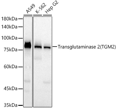 Western blot analysis of various lysates using Transglutaminase 2 (TGM2)  Rabbit mAb (A21184) at  1:10000 dilution.|Secondary antibody: HRP-conjugated Goat anti-Rabbit IgG (H+L) (AS014) at 1:10000 dilution.|Lysates/proteins: 25μg per lane.|Blocking buffer: 3% nonfat dry milk in TBST.|Detection: ECL Basic Kit (RM00020).|Exposure time: 10s.
