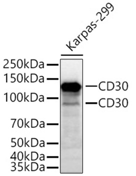 Western blot analysis of lysates from Karpas-299 cells using CD30 Rabbit mAb at 1:5000 dilution incubated at room temperature for 1.5 hours.|Secondary antibody: HRP-conjugated Goat anti-Rabbit IgG (H+L) at 1:10000 dilution.|Lysates/proteins: 25 μg per lane.|Blocking buffer: 3% nonfat dry milk in TBST.|Detection: ECL Basic Kit.|Exposure time: 45 s.