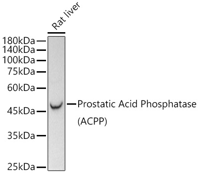 Western blot analysis of lysates from Rat liver, using Prostatic Acid Phosphatase (PSAP)  Rabbit mAb at1:1800 dilution.|Secondary antibody: HRP-conjugated Goat anti-Rabbit IgG (H+L) at 1:10000 dilution.|Lysates/proteins: 25μg per lane.|Blocking buffer: 3% nonfat dry milk in TBST.|Detection: ECL Basic Kit.|Exposure time: 90s.