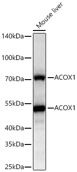 Western blot analysis of lysates from Mouse liver using ACOX1 Rabbit mAb at 1:12000 dilution incubated overnight at 4℃.|Secondary antibody: HRP-conjugated Goat anti-Rabbit IgG (H+L) at 1:10000 dilution.|Lysates/proteins: 25 μg per lane.|Blocking buffer: 3% nonfat dry milk in TBST.|Detection: ECL Basic Kit.|Exposure time: 1s.