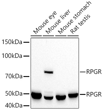 Western blot analysis of various lysates using RPGR Rabbit mAb at 1:1000 dilution incubated overnight at 4℃.|Secondary antibody: HRP-conjugated Goat anti-Rabbit IgG (H+L) at 1:10000 dilution.|Lysates/proteins: 25 μg per lane.|Blocking buffer: 3% nonfat dry milk in TBST.|Detection: ECL Basic Kit.|Exposure time: 90s.