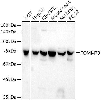 Western blot analysis of various lysates using TOM70 Rabbit mAb (A21210) at1:1800 dilution.|Secondary antibody: HRP-conjugated Goat anti-Rabbit IgG (H+L) (AS014) at 1:10000 dilution.|Lysates/proteins: 25μg per lane.|Blocking buffer: 3% nonfat dry milk in TBST.|Detection: ECL Basic Kit (RM00020).|Exposure time: 90s.