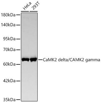 Western blot analysis of various lysates using CaMK2 delta/CAMK2 gamma Rabbit mAb at 1:11000 dilution incubated overnight at 4℃.|Secondary antibody: HRP-conjugated Goat anti-Rabbit IgG (H+L) at 1:10000 dilution.|Lysates/proteins: 25 μg per lane.|Blocking buffer: 3% nonfat dry milk in TBST.|Detection: ECL Basic Kit.|Exposure time: 90s.