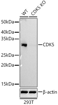 Western blot analysis of lysates from wild type (WT) and CDK5 knockout (KO) 293T cells using CDK5 Rabbit mAb (A26254) at 1:2000 dilution incubated overnight at 4℃.|Secondary antibody: HRP-conjugated Goat anti-Rabbit IgG (H+L) (AS014) at 1:10000 dilution.|Lysates/proteins: 25 μg per lane.|Blocking buffer: 3% nonfat dry milk in TBST.|Detection: ECL Basic Kit (RM00020).|Exposure time: 90s.