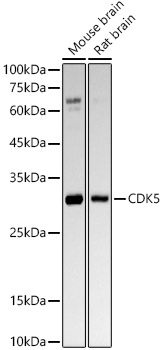 Western blot analysis of various lysates, using [KO Validated] CDK5 Rabbit mAb at1:2000 dilution.|Secondary antibody: HRP-conjugated Goat anti-Rabbit IgG (H+L) at 1:10000 dilution.|Lysates/proteins: 25μg per lane.|Blocking buffer: 3% nonfat dry milk in TBST.|Detection: ECL Basic Kit.|Exposure time: 180s.