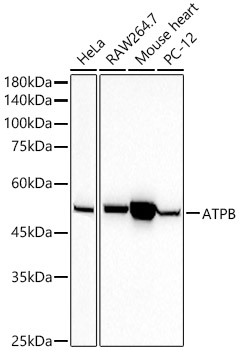 Western blot analysis of various lysates using ATPB Rabbit mAb at1:50000 dilution.|Secondary antibody: HRP-conjugated Goat anti-Rabbit IgG (H+L) at 1:10000 dilution.|Lysates/proteins: 25μg per lane.|Blocking buffer: 3% nonfat dry milk in TBST.|Detection: ECL Basic Kit.|Exposure time: 10s.