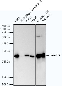 Western blot analysis of various lysates using Calretinin Rabbit mAb at1:170000 dilution.|Secondary antibody: HRP-conjugated Goat anti-Rabbit IgG (H+L) at 1:10000 dilution.|Lysates/proteins: 25μg per lane.|Blocking buffer: 3% nonfat dry milk in TBST.|Detection: ECL Basic Kit.|Exposure time: 30s.