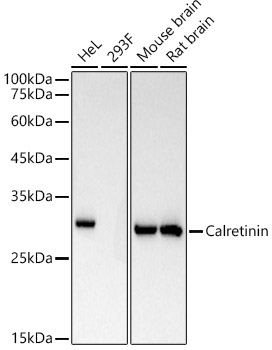 Western blot analysis of various lysates using Calretinin Rabbit mAb at1:110000 dilution.|Secondary antibody: HRP-conjugated Goat anti-Rabbit IgG (H+L) at 1:10000 dilution.|Lysates/proteins: 25μg per lane.|Blocking buffer: 3% nonfat dry milk in TBST.|Detection: ECL Basic Kit.|Exposure time: 10s.
