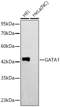 Western blot analysis of various lysates using GATA1 Rabbit mAbat 1:4000 dilution incubated overnight at 4℃.|Secondary antibody: HRP-conjugated Goat anti-Rabbit IgG (H+L) at 1:10000 dilution.|Lysates/proteins: 25 μg per lane.|Blocking buffer: 3% nonfat dry milk in TBST.|Detection: ECL Basic Kit.|Negative control (NC): HeLa|Exposure time: 30s.