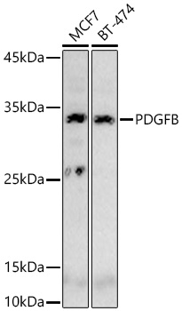 Western blot analysis of various lysates using PDGFB Rabbit mAb at 1:1000 dilution incubated overnight at 4℃.|Secondary antibody: HRP-conjugated Goat anti-Rabbit IgG (H+L) at 1:10000 dilution.|Lysates/proteins: 25 μg per lane.|Blocking buffer: 3% nonfat dry milk in TBST.|Detection: ECL Basic Kit.|Exposure time: 60 s.