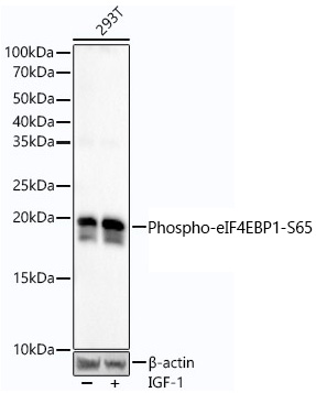 Western blot analysis of lysates from 293T cells using Phospho-eIF4EBP1-S65 Rabbit mAb at1:20000 dilution. 293T cells were treated with IGF-1 (50 ng/ml) at 37℃ for 5 minutes after serum-starvation overnight.|Secondary antibody: HRP-conjugated Goat anti-Rabbit IgG (H+L) at 1:10000 dilution.|Lysates/proteins: 25μg per lane.|Blocking buffer: 3% nonfat dry milk in TBST.|Detection: ECL Basic Kit.|Exposure time: 90s.