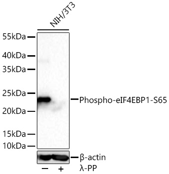 Western blot analysis of lysates from NIH/3T3 cells using Phospho-eIF4EBP1-S65 Rabbit mAb at 1:1000 dilution incubated at room temperature for 1.5 hours. NIH/3T3 cells were treated with λ-PP mixed solution (1ul) at 30℃ for 30 minutes.|Secondary antibody: HRP-conjugated Goat anti-Rabbit IgG (H+L) at 1:10000 dilution.|Lysates/proteins: 30 μg per lane.| Blocking buffer: 3 % nonfat dry milk in TBST.| Detection: ECL Basic Kit.| Exposure time: 90s.