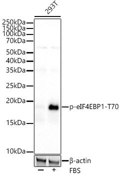Western blot analysis of lysates from 293T cells using Phospho-eIF4EBP1-T70 Rabbit mAb at 1:2000 dilution. 293T cells were treated with 10% FBS at 37℃ for 30 minutes after serum-starvation overnight.|Secondary antibody: HRP-conjugated Goat anti-Rabbit IgG (H+L) at 1:10000 dilution.|Lysates/proteins: 25μg per lane.|Blocking buffer: 3% nonfat dry milk in TBST.|Detection: ECL Basic Kit.|Exposure time: 180s.