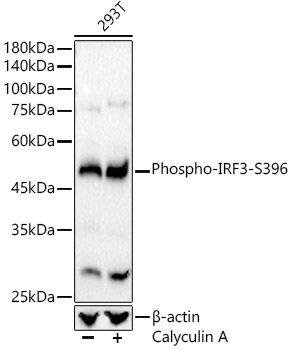 Western blot analysis of lysates from 293T cells, using Phospho-IRF3-S396 Rabbit mAb at 1:24000 dilution. 293T cells were treated with Calyculin A (100 nM) at 37℃ for 30 minutes after serum-starvation overnight.|Secondary antibody: HRP-conjugated Goat anti-Rabbit IgG (H+L) at 1:10000 dilution.|Lysates/proteins: 25μg per lane.|Blocking buffer: 3% nonfat dry milk in TBST.|Detection: ECL Basic Kit.|Exposure time: 60s.