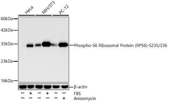 Western blot analysis of various lysates using Phospho-S6 Ribosomal Protein -S235/236 Rabbit mAb at 1:3000 dilution incubated at room temperature for 1.5 hours. HeLa cells were treated with 10% FBS at 37℃ for 30 minutes. NIH/3T3 cells were treated with 10% FBS at 37℃ for 1.5 hours. PC-12 cells were treated with Anisomycin (100 ng/mL) at 37℃ for 24 hours.|Secondary antibody: HRP-conjugated Goat anti-Rabbit IgG (H+L) at 1:10000 dilution.|Lysates/proteins: 30 μg per lane.|Blocking buffer: 3% nonfat dry milk in TBST.|Detection: ECL Basic Kit.|Exposure time: 30s.