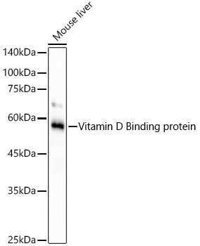 Western blot analysis of lysates from mouse liver, using Vitamin D Binding protein Rabbit mAb at 1:1000 dilution.|Secondary antibody: HRP-conjugated Goat anti-Rabbit IgG (H+L) at 1:10000 dilution.|Lysates/proteins: 25μg  per lane.|Blocking buffer: 3% nonfat dry milk in TBST.|Detection: ECL Basic Kit.|Exposure time: 90s.
