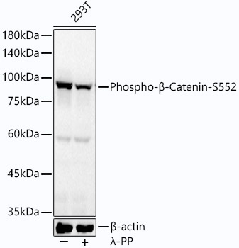 Western blot analysis of lysates from 293T cells, using Phospho-β-Catenin-S552 Rabbit mAb at 1:2000 dilution. 293T cells were treated by λ-PP mixed solution (1ul) at 30℃ for 30 minutes.|Secondary antibody: HRP-conjugated Goat anti-Rabbit IgG (H+L) at 1:10000 dilution.|Lysates/proteins: 25μg per lane.|Blocking buffer: 3% nonfat dry milk in TBST.|Detection: ECL Basic Kit.|Exposure time: 60s.