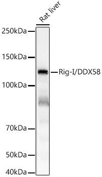 Western blot analysis of lysates from rat liver, using Rig-I/DDX58 Rabbit mAb at 1:4000 dilution.|Secondary antibody: HRP-conjugated Goat anti-Rabbit IgG (H+L) at 1:10000 dilution.|Lysates/proteins: 25μg per lane.|Blocking buffer: 3% nonfat dry milk in TBST.|Detection: ECL Basic Kit.|Exposure time: 10s.