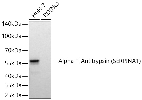 Western blot analysis of various lysates using Alpha-1 Antitrypsin (SERPINA1) Rabbit mAb at 1:63000 dilution .|Secondary antibody: HRP-conjugated Goat anti-Rabbit IgG (H+L) at 1:10000 dilution.|Lysates/proteins: 25 μg per lane.|Blocking buffer: 3% nonfat dry milk in TBST.|Detection: ECL Basic Kit.|Negative control (NC): RD|Exposure time: 30 s.
