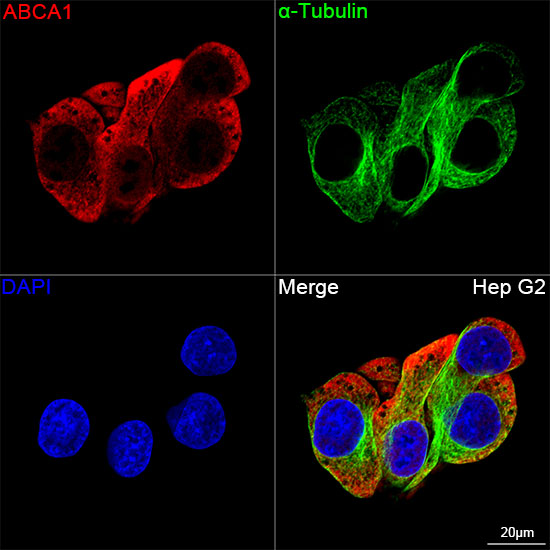 Confocal imaging of Hep G2 cells  using ABCA1 Rabbit mAb  followed by a further incubation with Cy3 Goat Anti-Rabbit IgG (H+L)(Red).The cells were counterstained with α-Tubulin Mouse mAb followed by incubation with PSFlo 488-conjugated Goat Anti-Mouse IgG (H+L) Ab (Green).DAPI was used for nuclear staining (Blue). Objective: 100x.