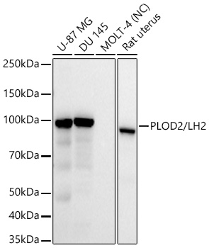 Western blot analysis of various lysates using PLOD2/LH2 Rabbit mAb at1:30000 dilution.|Secondary antibody: HRP-conjugated Goat anti-Rabbit IgG (H+L) at 1:10000 dilution.|Lysates/proteins: 25μg per lane.|Blocking buffer: 3% nonfat dry milk in TBST.|Detection: ECL Basic Kit.|Exposure time: 30s.