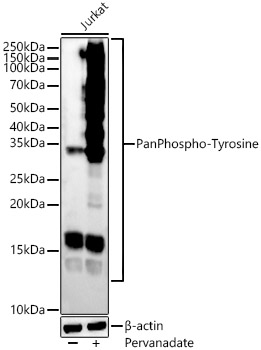 Western blot analysis of various lysates, using Pan Phospho-Tyrosine Rabbit mAb at 1:2000 dilution. Jurkat cells were treated with Pervanadate (1 mM) at 37℃ for 30 minutes.|Secondary antibody: HRP-conjugated Goat anti-Rabbit IgG (H+L) at 1:10000 dilution.|Lysates/proteins: 25μg per lane.|Blocking buffer: 3% nonfat dry milk in TBST.|Detection: ECL Basic Kit.|Exposure time: 90s.