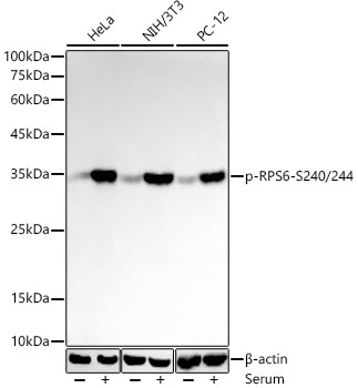 Western blot analysis of various lysates using Phospho-S6 Ribosomal Protein -S240/244 Rabbit mAb at 1:20000 dilution. HeLa and NIH/3T3 cell were treated with 10% FBS at 37℃ for 30 minutes after serum-starvation overnight. PC-12 cells were treated with 20% FBS at 37℃ for 20 minutes after serum-starvation overnight.|Secondary antibody: HRP-conjugated Goat anti-Rabbit IgG (H+L) at 1:10000 dilution.|Lysates/proteins: 25μg per lane.|Blocking buffer: 3% nonfat dry milk in TBST.|Detection: ECL Basic Kit.|Exposure time: 30s.