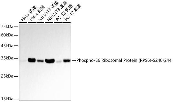 Western blot analysis of various lysates using Phospho-S6 Ribosomal Protein -S240/244 Rabbit mAb at 1:20000 dilution incubated overnight at 4℃. HeLa, NIH/3T3 and PC-12 cells were treated with 10% FBS at 37℃ for 30 minutes after serum-starvation overnight.|Secondary antibody: HRP-conjugated Goat anti-Rabbit IgG (H+L) at 1:10000 dilution.|Lysates/proteins: 30 μg per lane.|Blocking buffer: 3% nonfat dry milk in TBST.|Detection: ECL Basic Kit.|Exposure time: 30 s.