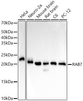 Western blot analysis of various lysates, using RAB7 Rabbit mAb at 1:6000 dilution.|Secondary antibody: HRP-conjugated Goat anti-Rabbit IgG (H+L) at 1:10000 dilution.|Lysates/proteins: 25μg per lane.|Blocking buffer: 3% nonfat dry milk in TBST.|Detection: ECL Basic Kit.|Exposure time: 10s.