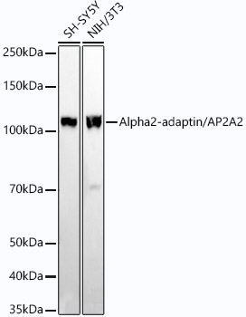 Western blot analysis of various lysates using Alpha2-adaptin/AP2A2 Rabbit mAb at1:20000 dilution.|Secondary antibody: HRP-conjugated Goat anti-Rabbit IgG (H+L) at 1:10000 dilution.|Lysates/proteins: 25μg per lane.|Blocking buffer: 3% nonfat dry milk in TBST.|Detection: ECL Basic Kit.|Exposure time: 180s.