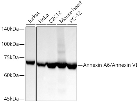 Western blot analysis of various lysates using Annexin A6/Annexin VI Rabbit mAb at 1:23000 dilution incubated overnight at 4℃.|Secondary antibody: HRP-conjugated Goat anti-Rabbit IgG (H+L) at 1:10000 dilution.|Lysates/proteins: 25 μg per lane.|Blocking buffer: 3% nonfat dry milk in TBST.|Detection: ECL Basic Kit.|Exposure time: 10s.