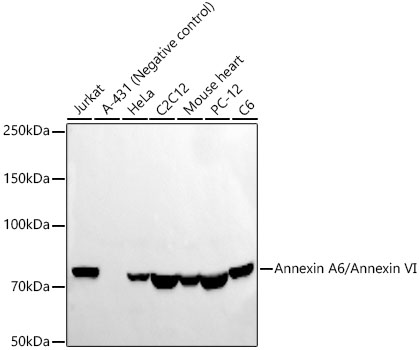 Western blot analysis of various lysates using Annexin A6/Annexin VI Rabbit mAb at1:8000 dilution.|Secondary antibody: HRP-conjugated Goat anti-Rabbit IgG (H+L) at 1:10000 dilution.|Lysates/proteins: 25μg per lane.|Blocking buffer: 3% nonfat dry milk in TBST.|Detection: ECL Basic Kit.|Exposure time: 60s.