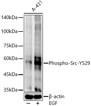 Western blot analysis of lysates from A-431 cells, using Phospho-Src-Y529 Rabbit mAb at 1:10000 dilution. A-431 cells were treated with EGF (100 ng/ml) at 37℃ for 30 minutes after serum-starvation overnight.|Secondary antibody: HRP-conjugated Goat anti-Rabbit IgG (H+L) at 1:10000 dilution.|Lysates/proteins: 25μg per lane.|Blocking buffer: 3% nonfat dry milk in TBST.|Detection: ECL Basic Kit.|Exposure time: 30s.