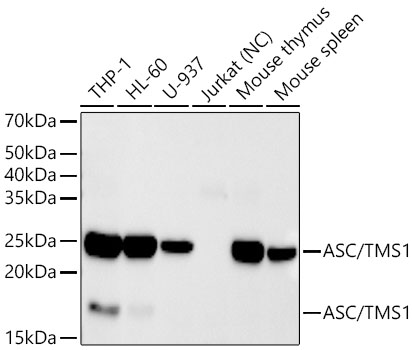 Western blot analysis of various lysates using ASC/TMS1 Rabbit mAb at 1:20000 dilution.|Secondary antibody: HRP-conjugated Goat anti-Rabbit IgG (H+L) at 1:10000 dilution.|Lysates/proteins: 25 μg per lane.|Blocking buffer: 3% nonfat dry milk in TBST.|Detection: ECL Basic Kit.|Negative control (NC): Jurkat.|Exposure time: 180s.