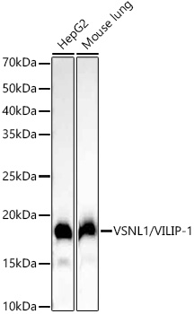 Western blot analysis of various lysates using VSNL1/VILIP-1 Rabbit mAb at1:2000 dilution.|Secondary antibody: HRP-conjugated Goat anti-Rabbit IgG (H+L) at 1:10000 dilution.|Lysates/proteins: 25μg per lane.|Blocking buffer: 3% nonfat dry milk in TBST.|Detection: ECL Basic Kit.|Exposure time: 10s.