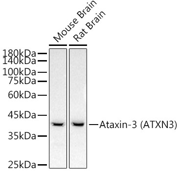 Western blot analysis of extracts from various lysates, using Ataxin-3 antibody at 1:2000 dilution.|Secondary antibody: HRP Goat Anti-Rabbit IgG (H+L) at 1:10000 dilution.|Lysates/proteins: 25μg  per lane.Blocking buffer: 3% nonfat dry milk in TBST.|Detection: ECL Basic Kit.|Exposure time: 30s.