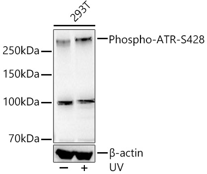 Western blot analysis of lysates from 293T cells using Phospho-ATR-S428 Rabbit mAb at1:2000 dilution. 293T cells were treated with UV at room temperature for 15-30 minutes.|Secondary antibody: HRP-conjugated Goat anti-Rabbit IgG (H+L) at 1:10000 dilution.|Lysates/proteins: 30 μg per lane.|Blocking buffer: 3% nonfat dry milk in TBST.|Detection: ECL Basic Kit.|Exposure time: 90 s.
