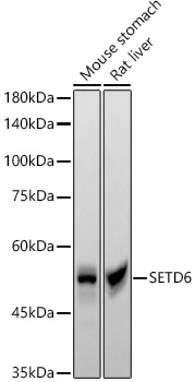 Western blot analysis of various lysates, using SETD6 Rabbit mAb at  1:2000 dilution.|Secondary antibody: HRP-conjugated Goat anti-Rabbit IgG (H+L) at 1:10000 dilution.|Lysates/proteins: 25μg per lane.|Blocking buffer: 3% nonfat dry milk in TBST.|Detection: ECL Basic Kit.|Exposure time: 90s.