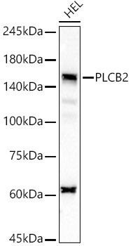 Western blot analysis of lysates from HEL cells, using PLCB2 Rabbit mAb at 1:2000 dilution.|Secondary antibody: HRP-conjugated Goat anti-Rabbit IgG (H+L) at 1:10000 dilution.|Lysates/proteins: 25μg per lane.|Blocking buffer: 3% nonfat dry milk in TBST.|Detection: ECL Basic Kit.|Exposure time: 30s.