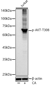 Western blot analysis of lysates from Jurkat cells, using Phospho-Akt-T308 Rabbit mAb at1:2000 dilution. Jurkat cells were treated with Calyculin A (100 nM) at 37℃ for 30 minutes.|Secondary antibody: HRP-conjugated Goat anti-Rabbit IgG (H+L) at 1:10000 dilution.|Lysates/proteins: 25μg per lane.|Blocking buffer: 3% nonfat dry milk in TBST.|Detection: ECL Basic Kit.|Exposure time: 10s.