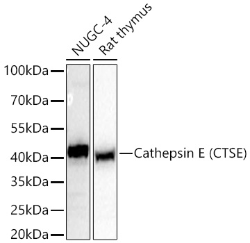 Western blot analysis of various lysates using Cathepsin E (CTSE) Rabbit mAb at 1:5000 dilution incubated overnight at 4℃.|Secondary antibody: HRP-conjugated Goat anti-Rabbit IgG (H+L) at 1:10000 dilution.|Lysates/proteins: 25 μg per lane.|Blocking buffer: 3% nonfat dry milk in TBST.|Detection: ECL Basic Kit.|Exposure time: 1 s.