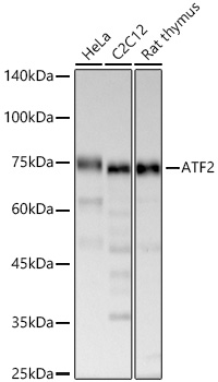 Western blot analysis of various lysates, using ATF2 Rabbit mAb at  1:60000 dilution.|Secondary antibody: HRP-conjugated Goat anti-Rabbit IgG (H+L) at 1:10000 dilution.|Lysates/proteins: 25μg per lane.|Blocking buffer: 3% nonfat dry milk in TBST.|Detection: ECL Basic Kit.|Exposure time: 180s.