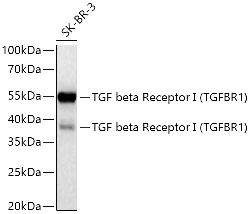Western blot analysis of lysates from SK-BR-3 cells using TGF beta Receptor I (TGFBR1) Rabbit mAb (A22151) at 1:5000 dilution incubated at room temperature for 1.5 hours.|Secondary antibody: HRP-conjugated Goat anti-Rabbit IgG (H+L) (AS014) at 1:10000 dilution.|Lysates/proteins: 25 μg per lane.|Blocking buffer: 3% nonfat dry milk in TBST.|Detection: ECL Basic Kit (RM00020).|Exposure time: 90 s.