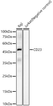 Western blot analysis of various lysates, using CD23 Rabbit mAb at  1:1000 dilution.|Secondary antibody: HRP-conjugated Goat anti-Rabbit IgG (H+L) at 1:10000 dilution.|Lysates/proteins: 25μg per lane.|Blocking buffer: 3% nonfat dry milk in TBST.|Detection: ECL Basic Kit.|Exposure time: 60s.