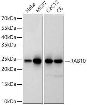 Western blot analysis of various lysates, using RAB10 Rabbit mAb at  1:60000 dilution.|Secondary antibody: HRP-conjugated Goat anti-Rabbit IgG (H+L) at 1:10000 dilution.|Lysates/proteins: 25μg per lane.|Blocking buffer: 3% nonfat dry milk in TBST.|Detection: ECL Basic Kit.|Exposure time: 180s.