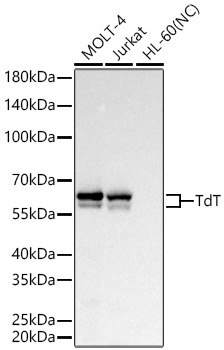 Western blot analysis of various lysates using TdT Rabbit mAb (A22618) at 1:1000 dilution incubated overnight at 4℃.|Secondary antibody: HRP-conjugated Goat anti-Rabbit IgG (H+L) (AS014) at 1:10000 dilution.|Lysates/proteins: 25 μg per lane.|Blocking buffer: 3% nonfat dry milk in TBST.|Detection: ECL Basic Kit (RM00020).|Negative control (NC): HL-60|Exposure time: 2s.